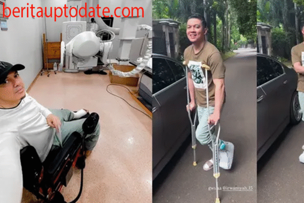 Irwansyah Usai Alami Patah Tulang di Kaki, Dibantu Pakai Tongkat Irwansyah